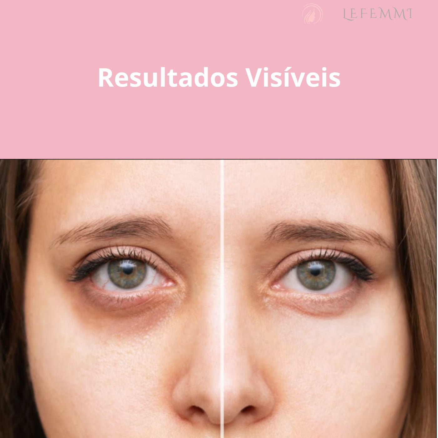 Glowup® Máscara para Redução de olheiras e rugas de expressão em Minutos - LeFemmi