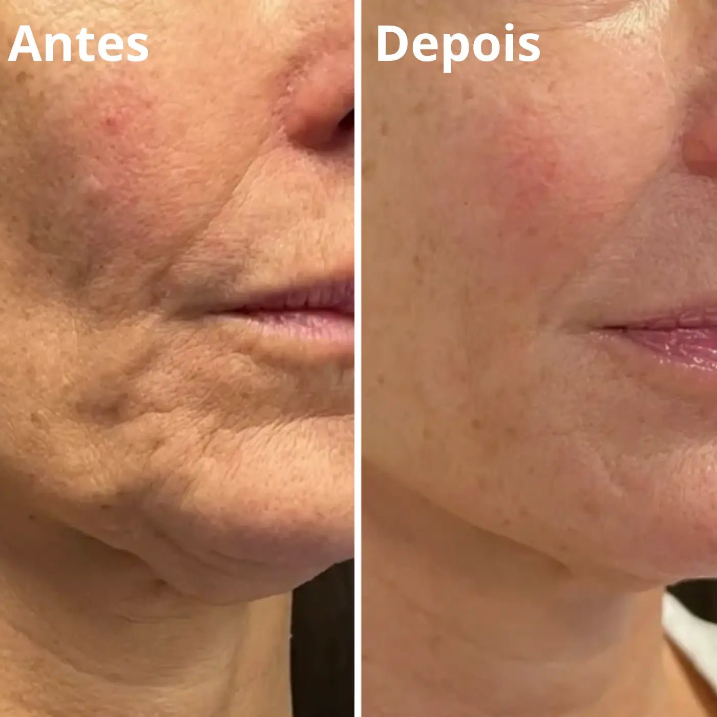 Antes e depois 3