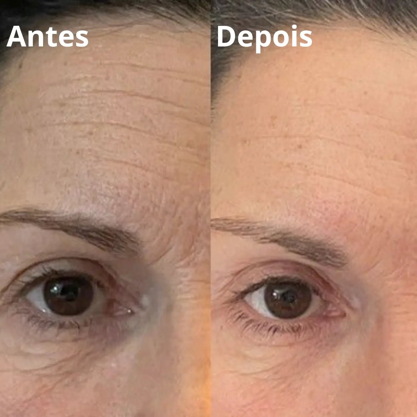 Antes e depois 2