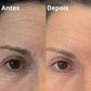 Antes e depois 2