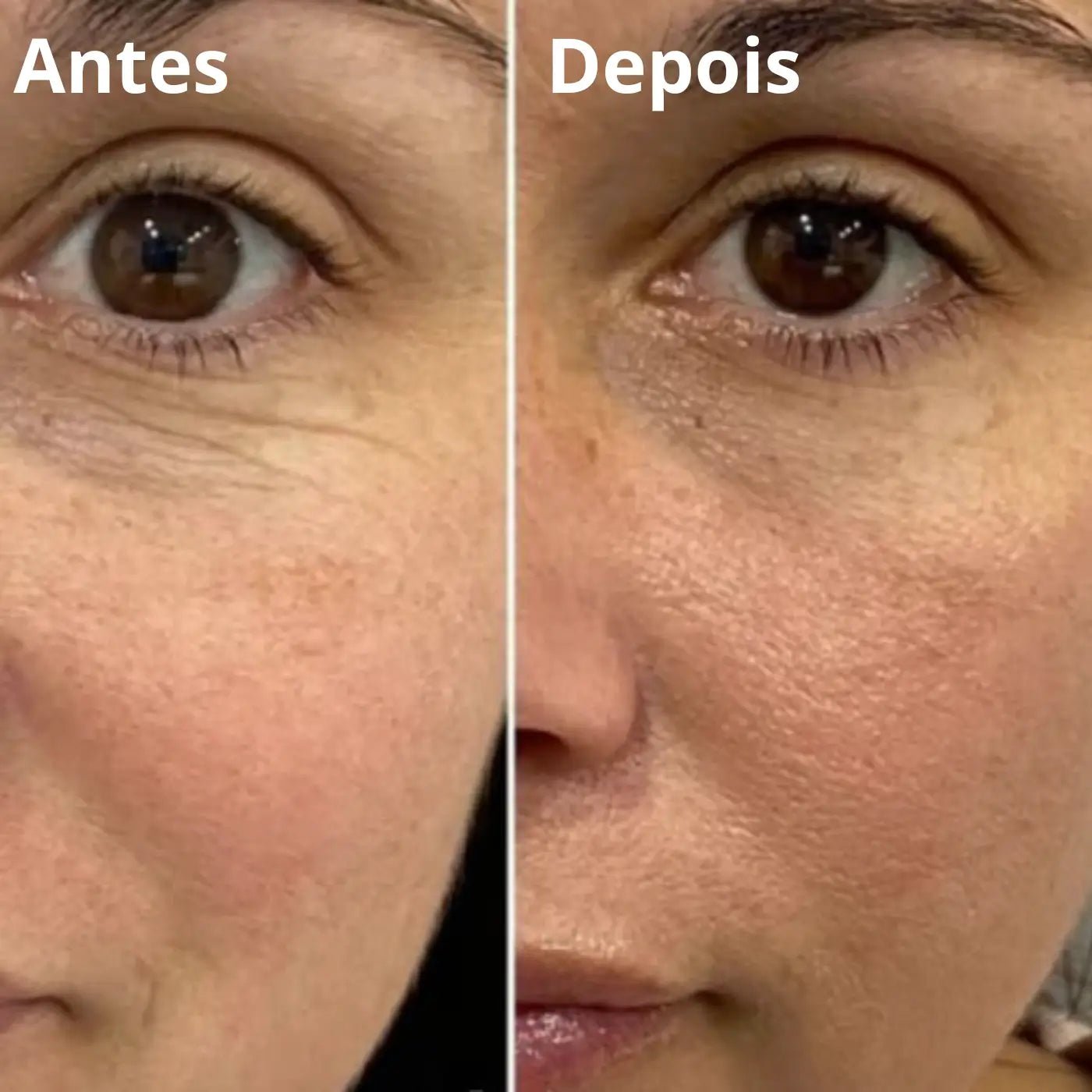 Antes e depois 1